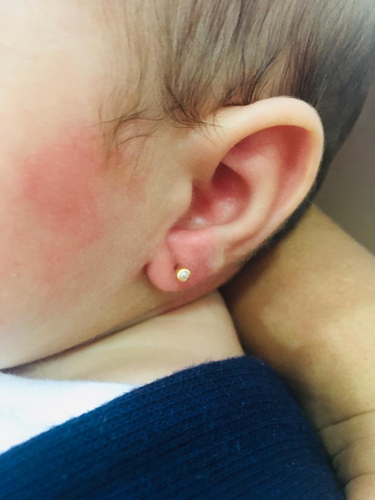 Previmune São Carlos Clínica de Vacina Imagem de Furinho Humanizado