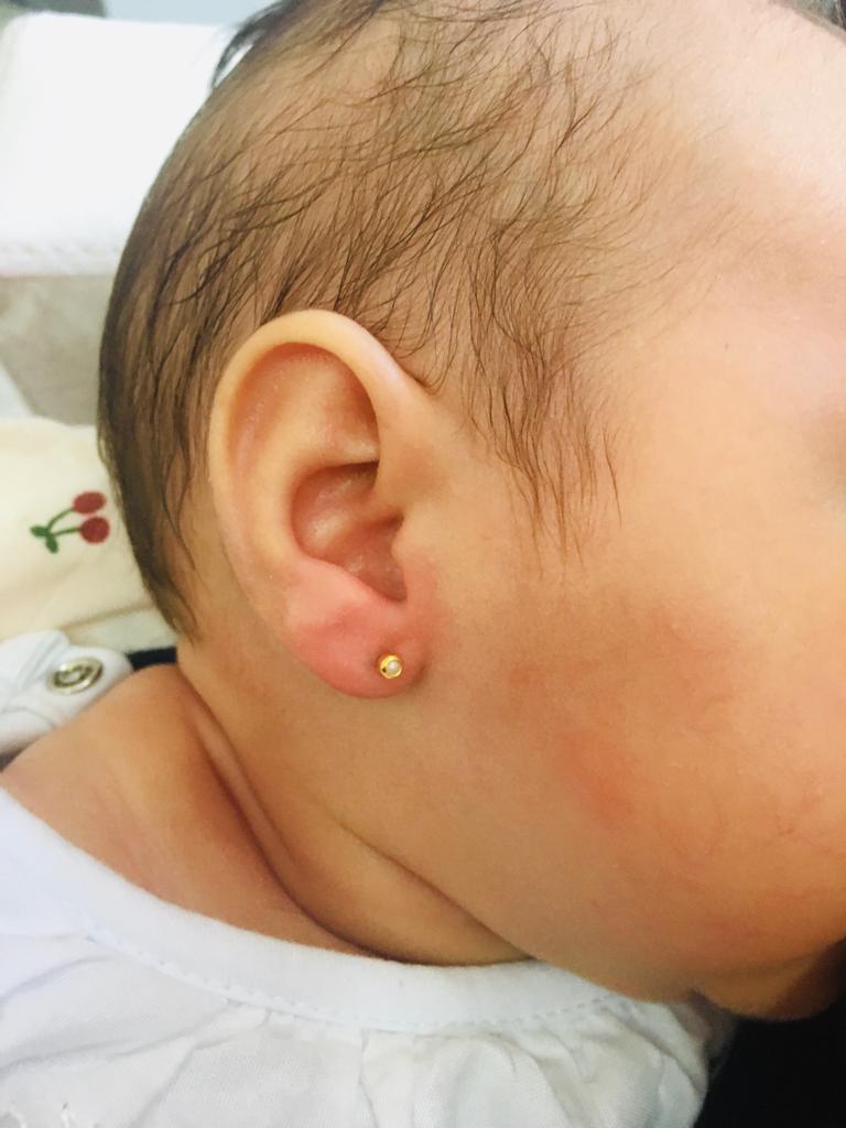 Previmune São Carlos Clínica de Vacina Imagem de Furinho Humanizado